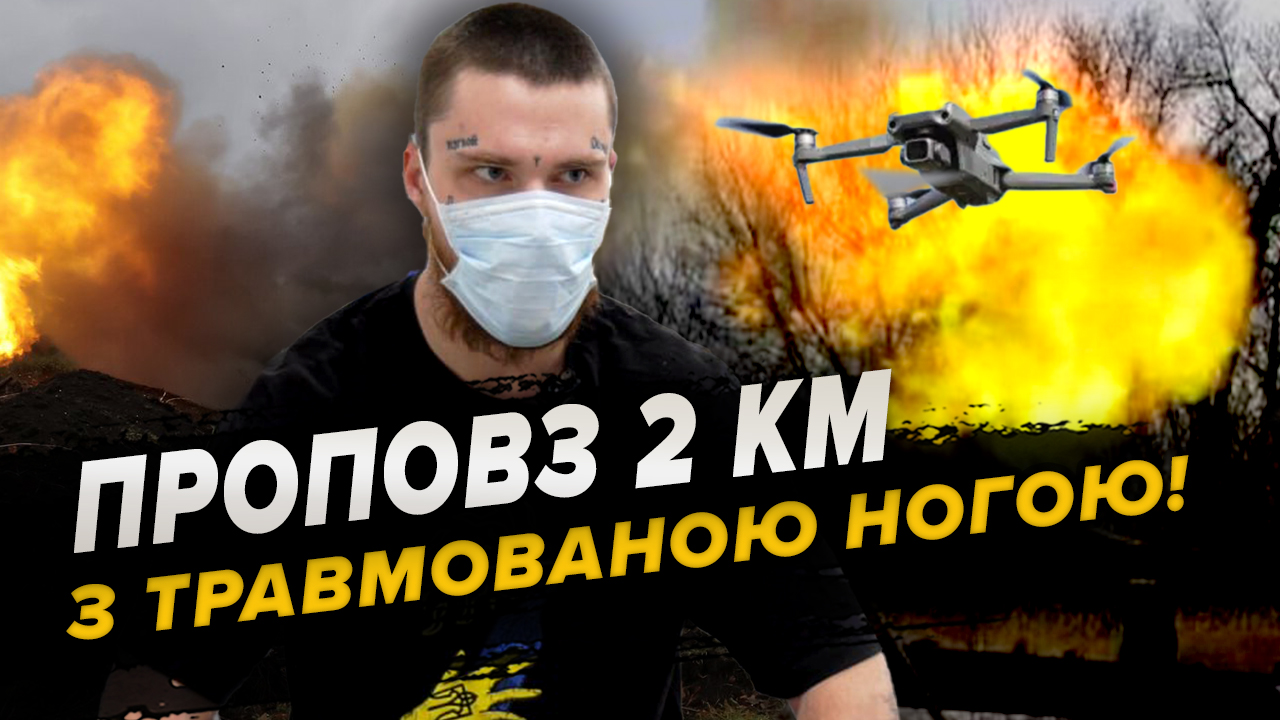 Потрапив під обстріл, рятуючи побратимів, з-під завалів: боєць “Азову” відновлюється у Дніпрі!