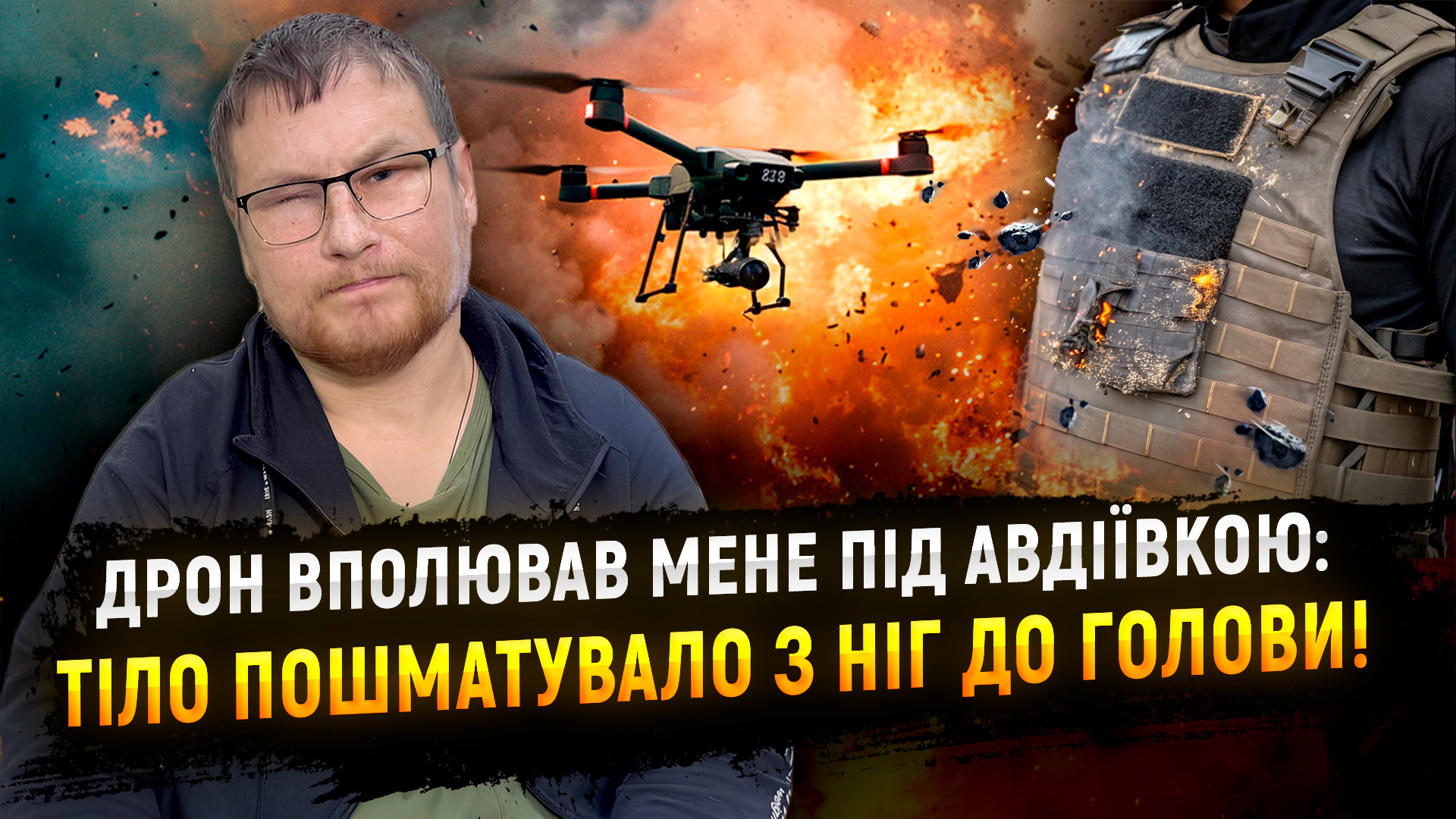 Бронік — весь в уламках, як їжак! Після скиду дрона залишився без ноги, пальців і з пробитим оком