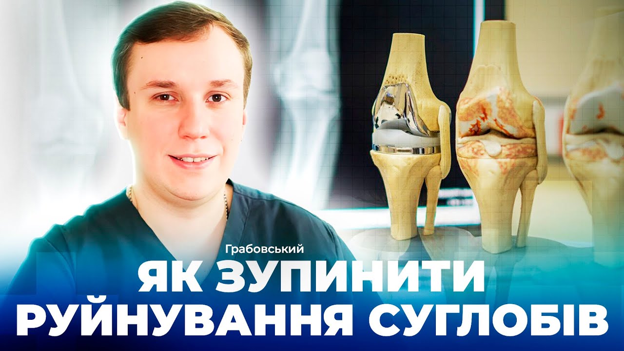 Артроз — не вирок: сучасні методи лікування та діагностики 30.10.2025