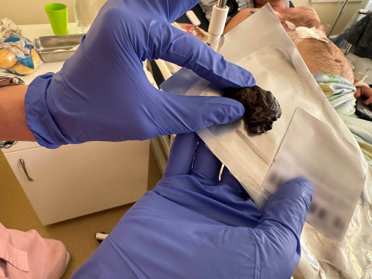 У міській лікарні Дніпра врятували 123 постраждалих після вибухів 24 червня