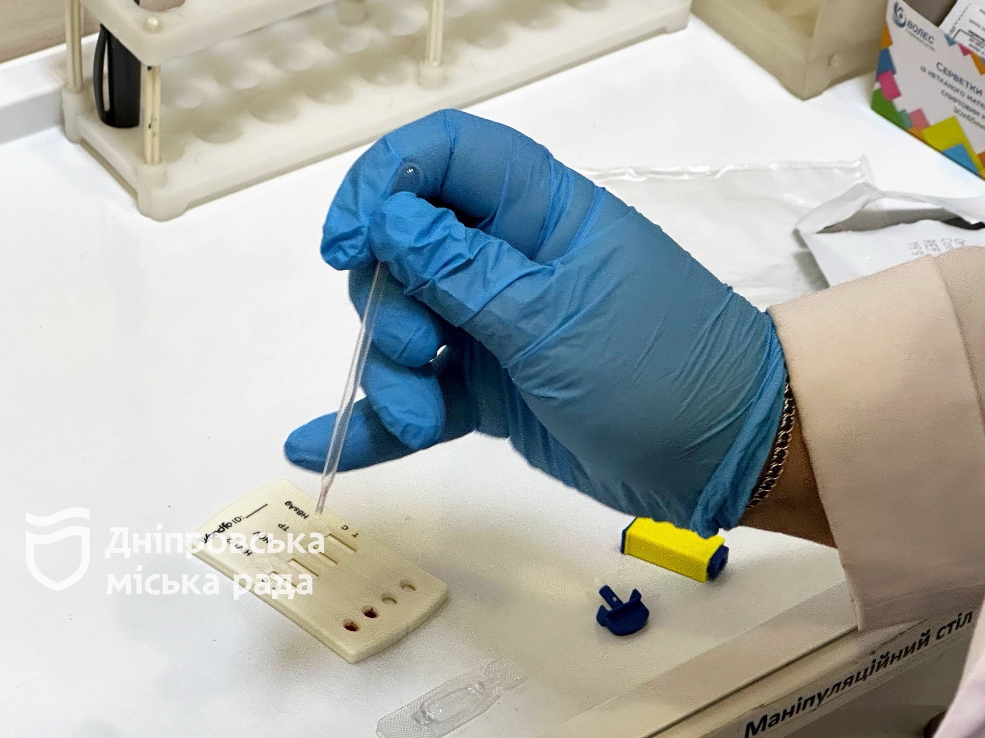 Дніпро: боротьба з ВІЛ та підтримка пацієнтів - 01.12.2025