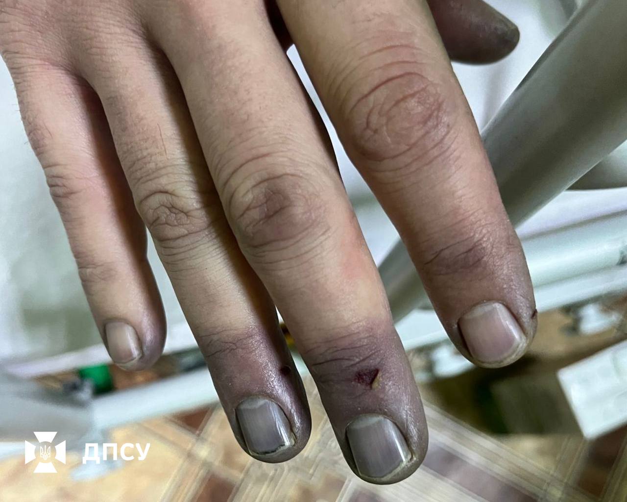 Двоє чоловіків з Дніпра та Полтавщини отримали обмороження при спробі перетнути кордон на Рівненщині - 13.01.2026