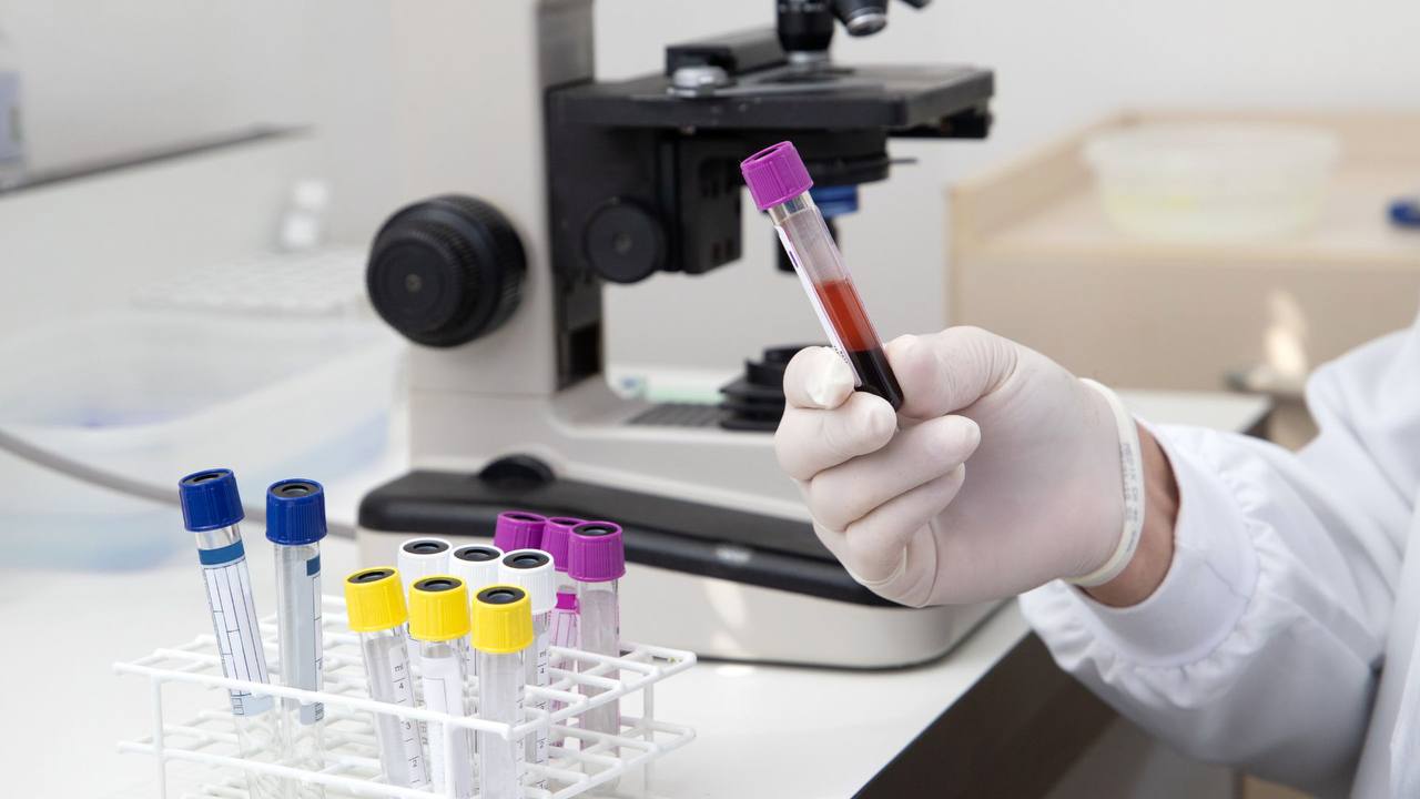 У Дніпрі від грипу А помер 69-річний чоловік