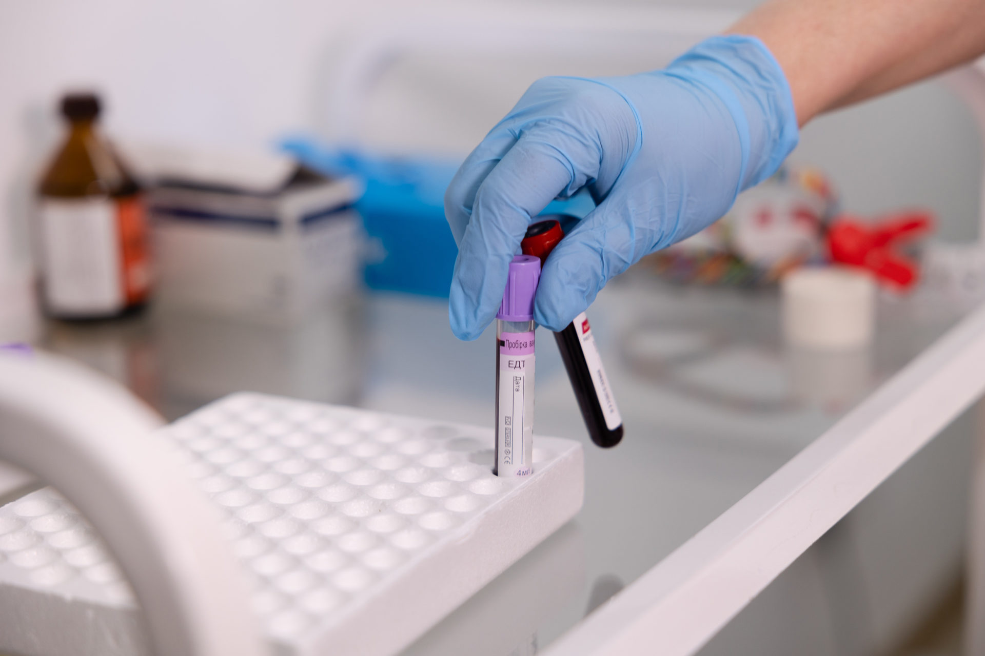 Понад 1500 людей пройшли «Скринінг здоров’я 40+» на Дніпропетровщині - 02.04.2026