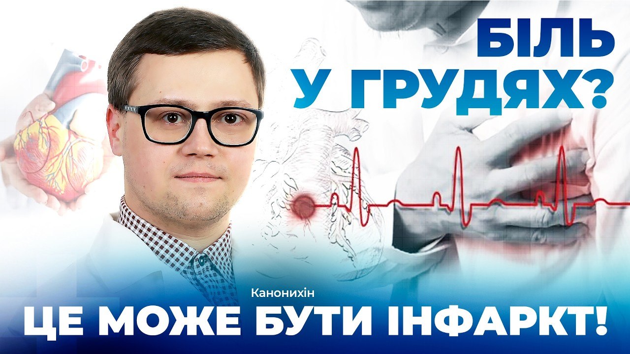 Інфаркт серця: коли стент рятує життя - 02.04.2026