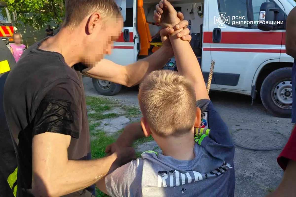 У Кам’янському надзвичайники визволили хлопчика, який напоровся рукою на штир огорожі - 06.06.2026