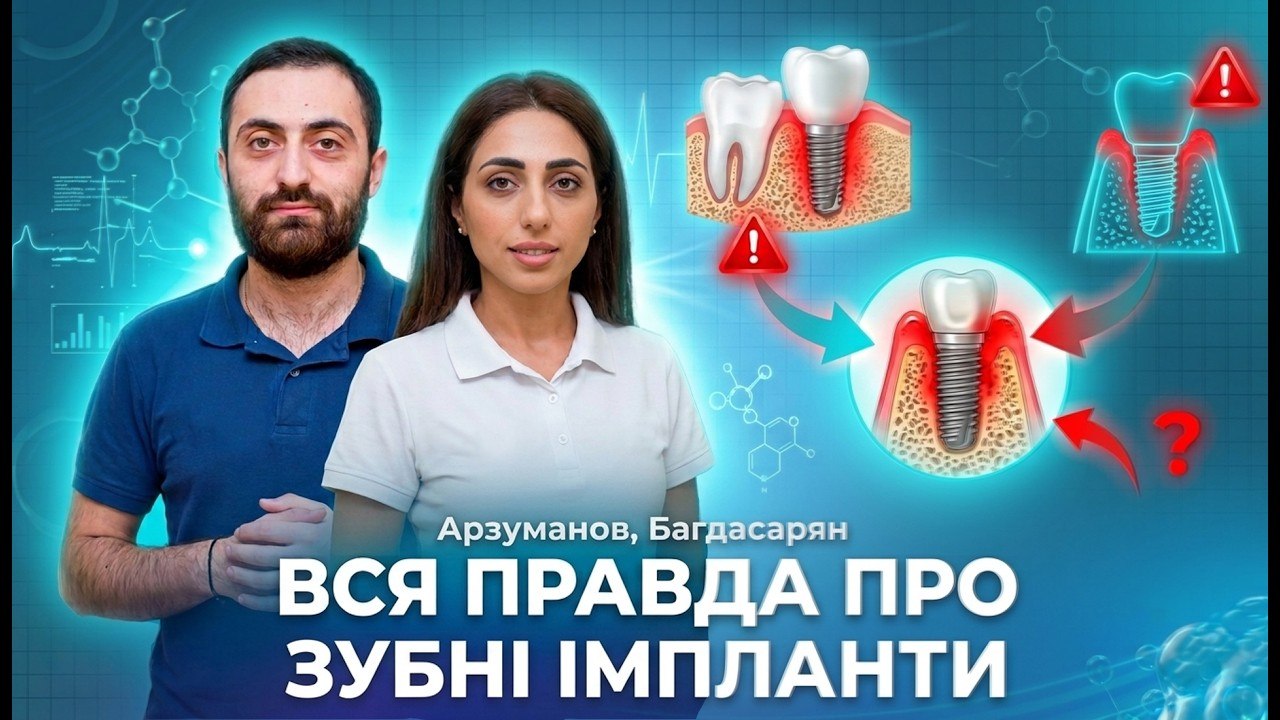 Зубні імпланти: міфи, ризики та відповіді на головні запитання - 30.07.2026