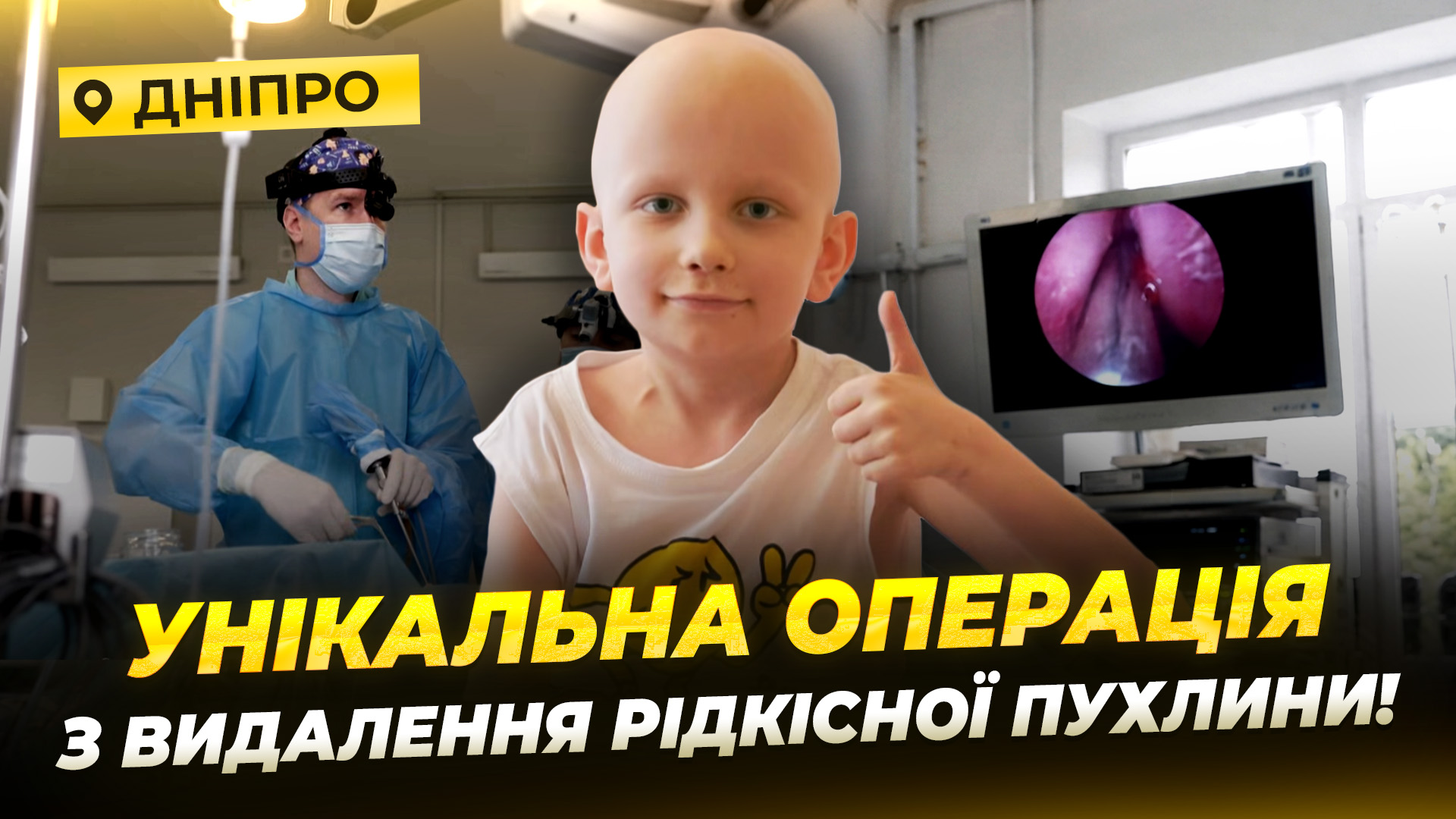 Видалили пухлину основи черепа без розрізів: у Дніпрі провели унікальну операцію 8-річному хлопчику - 21.08.2026