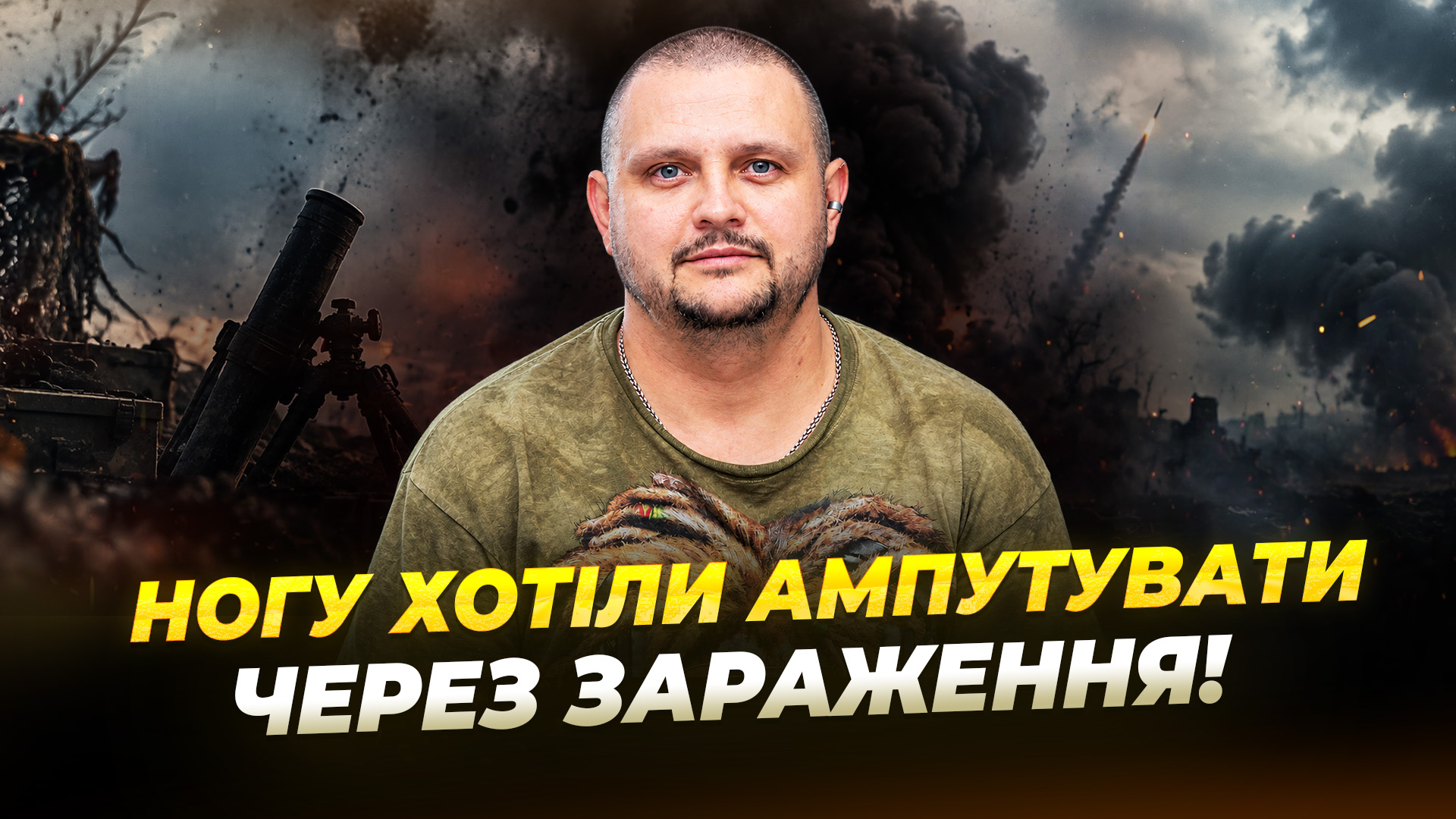 Евакуація через 6 годин після поранення та загроза ампутації кінцівки: історія відновлення ветерана - 24.09.2026 