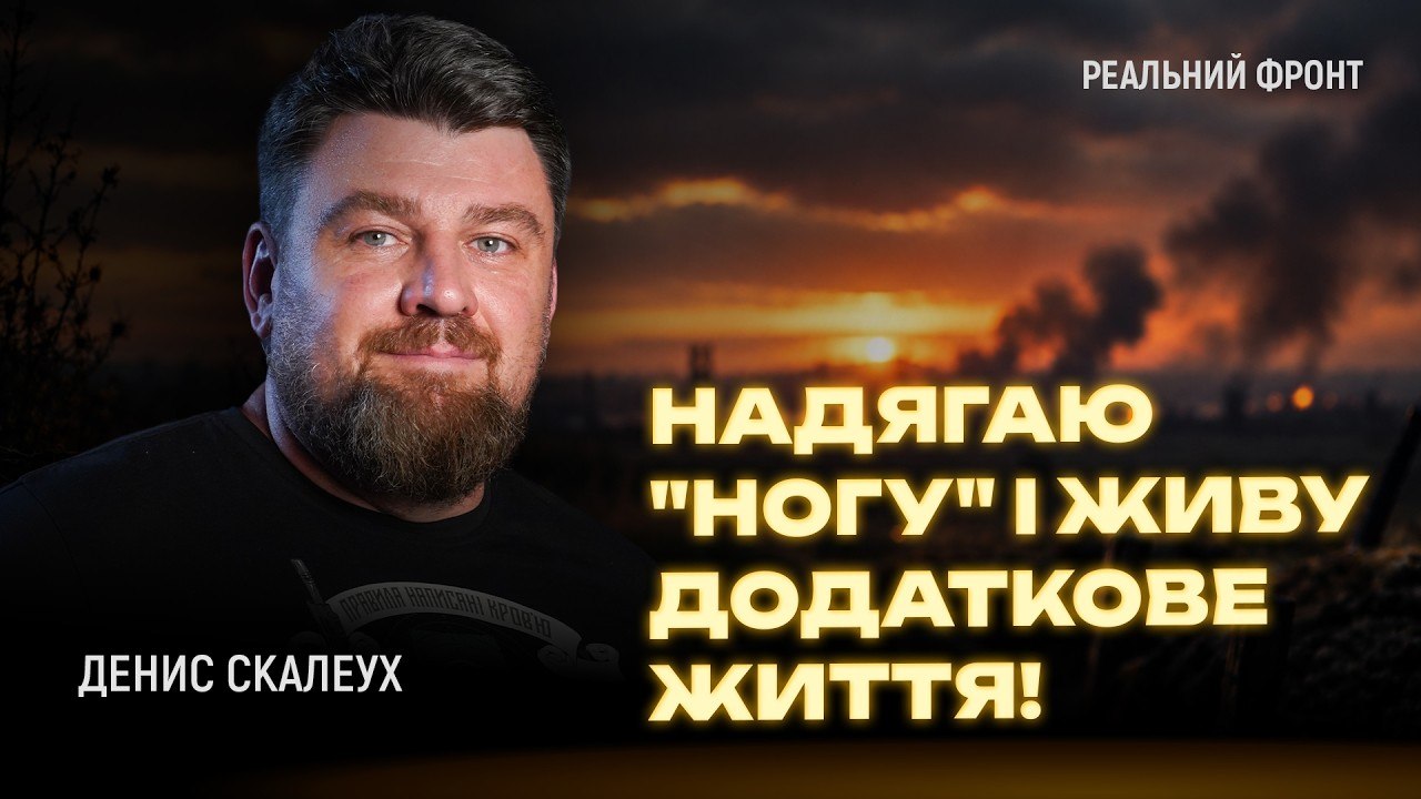 «**лі ви розсілися — там мій побратим!»: Денис Скалеух про епічну евакуацію та життя після ампутації - 01.10.2026